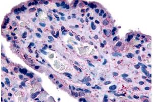Human Placenta (formalin-fixed, paraffin-embedded) stained with SLC7A5 antibody ABIN213435 at 20 ug/ml followed by biotinylated goat anti-rabbit IgG secondary antibody ABIN481713, alkaline phosphatase-streptavidin and chromogen. (SLC7A5 Antikörper  (N-Term))