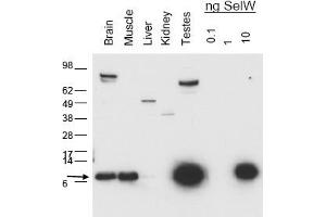 Image no. 1 for anti-Selenoprotein W, 1 (SEPW1) antibody (ABIN401399) (Selenoprotein W Antikörper)