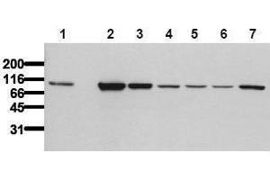 Western Blotting (WB) image for anti-Catenin (Cadherin-Associated Protein), beta 1, 88kDa (CTNNB1) (Exon 2), (N-Term) antibody (ABIN126745) (CTNNB1 Antikörper  (Exon 2, N-Term))