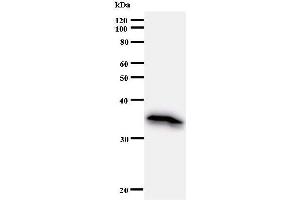 Western Blotting (WB) image for anti-Elongation Factor, RNA Polymerase II, 2 (ELL2) antibody (ABIN930983)