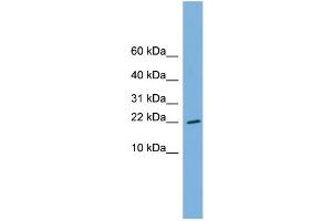 WB Suggested Anti-RPS13 Antibody Titration: 0. (RPS13 Antikörper  (Middle Region))
