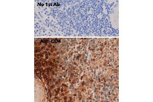 Immunohistochemistry (IHC) image for anti-CD4 (CD4) antibody (ABIN6254232) (CD4 Antikörper)
