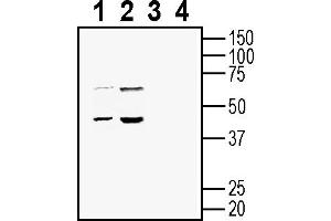 anti-Solute Carrier Family 25 (Mitochondrial Carrier: Glutamate), Member 22 (SLC25A22) (AA 91-106), (Intracellular) antibody