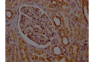 IHC image of ABIN7127782 diluted at 1:100 and staining in paraffin-embedded human kidney tissue performed on a Leica BondTM system. (Rekombinanter PTGER2 Antikörper)