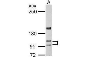 WB Image Sample (30 ug of whole cell lysate) A: BCL-1 5% SDS PAGE antibody diluted at 1:5000 (ATP2A3 Antikörper  (N-Term))
