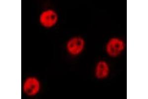 ABIN6275790 staining HepG2 by IF/ICC. (CSRNP3 Antikörper  (Internal Region))