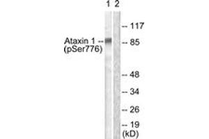 Western blot analysis of extracts from HepG2 cells treated with Adriamycin 0. (Ataxin 1 Antikörper  (pSer776))