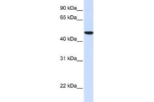 WB Suggested Anti-SLC2A6 Antibody Titration:  0.