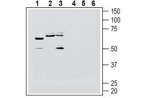 Western blot analysis of human Jurkat T-cell leukemia cell line lysate (lanes 1 and 4), human U-87 MG glioblastoma cell line lysate (lanes 2 and 5) and human SH-SY5Y neuroblastoma cell line lysate (lanes 3 and 6): - 1-3. (HRH1 Antikörper  (2nd Extracellular Loop))
