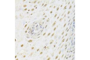 Immunohistochemistry of paraffin-embedded human esophagus using HDAC3 Antibody (ABIN5971166) at dilution of 1/100 (40x lens). (HDAC3 Antikörper)