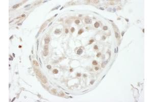 anti-General Transcription Factor IIH, Polypeptide 1, 62kDa (GTF2H1) (AA 250-300) antibody