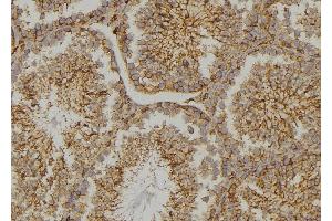 ABIN6273478 at 1/100 staining  testis tissue by IHC-P.
