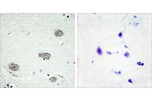 P-peptide - +Immunohistochemistry analysis of paraffin-embedded human brain tissue using CSFR (Phospho-Tyr809) antibody. (CSF1R Antikörper  (pTyr809))