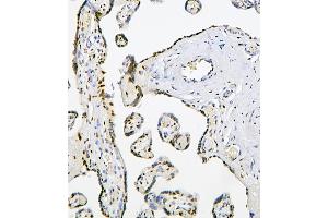 IHC analysis of PHF21A using anti-PHF21A antibody (ABIN6719353).
