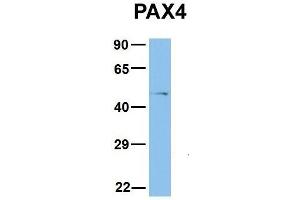 Host:  Rabbit  Target Name:  PAX4  Sample Type:  COLO205  Antibody Dilution:  1. (PAX4 Antikörper  (Middle Region))
