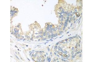 Immunohistochemistry of paraffin-embedded Human prostate using CUL3 Polyclonal Antibody at dilution of 1:100 (40x lens). (Cullin 3 Antikörper)