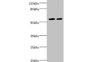 Western blot All lanes: ALDH4A1 antibody at 13 μg/mL Lane 1: K562 whole cell lysate Lane 2: 293T whole cell lysate Secondary Goat polyclonal to rabbit IgG at 1/10000 dilution Predicted band size: 62, 56, 57 kDa Observed band size: 62 kDa (ALDH4A1 Antikörper  (AA 354-563))