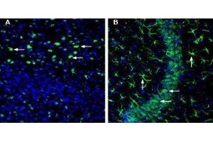 Expression of OCT3 (SLC22A3) in mouse cortex and hippocampus - Immunohistochemical staining of perfusion-fixed frozen mouse brain sections with Anti-SLC22A3 (extracellular) Antibody (ABIN7043416, ABIN7044223 and ABIN7044224), (1:200), followed by goat anti-rabbit-AlexaFluor-488. (SLC22A3 Antikörper  (Extracellular))