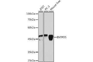 Western blot analysis of extracts of various cell lines, using ENTPD5 Rabbit mAb (ABIN7266895) at 1:3000 dilution. (ENTPD5 Antikörper)