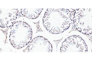 Immunohistochemistry of paraffin-embedded Mouse testis using Bcl9 Polyclonal Antibody at dilution of 1:100 (20x lens). (BCL9 Antikörper)