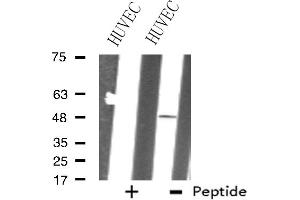 Western blot analysis of extracts from HUVEC cells, using ZNF24 antibody. (ZNF24 Antikörper  (Internal Region))