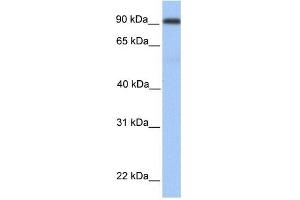 MMEL1 antibody used at 1 ug/ml to detect target protein. (MMEL1 Antikörper  (Middle Region))