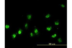 Image no. 2 for anti-NIMA (Never In Mitosis Gene A)-Related Kinase 11 (NEK11) (AA 1-483) antibody (ABIN599307) (NEK11 Antikörper  (AA 1-483))