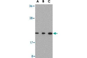 Western blot analysis of TMED10 in Raji cell lysate with TMED10 polyclonal antibody  at (A) 0.