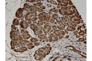 Immunoperoxidase of monoclonal antibody to CACNA2D2 on formalin-fixed paraffin-embedded human pancreas. (CACNA2D2 Antikörper  (AA 65-162))