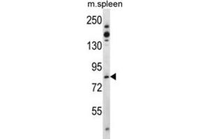 Western Blotting (WB) image for anti-TCDD-Inducible Poly(ADP-Ribose) Polymerase (Tiparp) antibody (ABIN3003615)