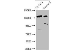 Western Blot Positive WB detected in: SH-SY5Y whole cell lysate, Ntera-2 whole cell lysate All lanes: ROBO2 antibody at 1:2000 Secondary Goat polyclonal to rabbit IgG at 1/50000 dilution Predicted band size: 131, 152, 154 kDa Observed band size: 152 kDa (ROBO2 Antikörper  (AA 450-660))