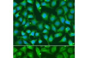 Immunofluorescence analysis of A549 cells using XRCC2 Polyclonal Antibody (XRCC2 Antikörper)