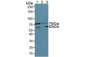 Western blot analysis of (1) Mouse Pancreas Tissue, (2) Human HeLa cells and (3) Human 293T Cells. (ATF6 Antikörper  (AA 423-646))