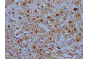IHC image of ABIN7180448 diluted at 1:100 and staining in paraffin-embedded human liver tissue performed on a Leica BondTM system. (Liver Arginase Antikörper)