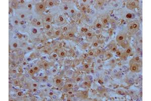 Immunohistochemistry (IHC) image for anti-Arginase, Liver (ARG1) antibody (ABIN7180448)
