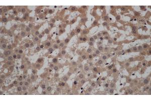 Immunohistochemistry of paraffin-embedded Rat liver using CALCRL Polyclonal Antibody at dilution of 1:50 (CALCRL Antikörper)