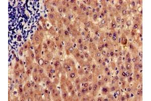 Immunohistochemistry of paraffin-embedded human liver tissue using ABIN7155233 at dilution of 1:100 (HRH1 Antikörper  (AA 211-416))