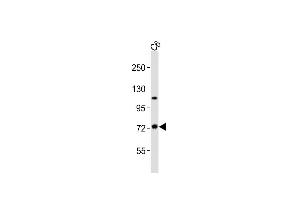 Anti-TAB2 Antibody (C-term)at 1:2000 dilution + C6 whole cell lysates Lysates/proteins at 20 μg per lane. (TAB2 Antikörper  (C-Term))