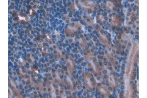 DAB staining on IHC-P; Samples: Mouse Kidney Tissue (TOR1AIP2 Antikörper  (AA 250-475))