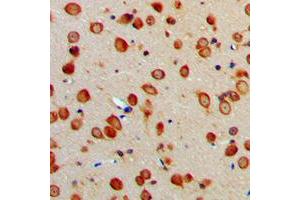 Immunohistochemical analysis of ERAP1 staining in human brain formalin fixed paraffin embedded tissue section. (ERAP1 Antikörper  (Center))