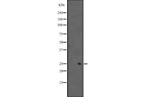 MIXL1 Antikörper  (Internal Region)