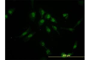 Immunofluorescence of monoclonal antibody to IRX5 on HeLa cell. (IRX5 Antikörper  (AA 204-264))