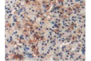 Immunohistochemistry (IHC) image for anti-Dihydrolipoamide Dehydrogenase (DLD) (AA 238-466) antibody (ABIN1858649)