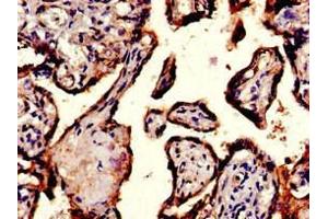 Immunohistochemistry of paraffin-embedded human placenta tissue using ABIN7156442 at dilution of 1:100 (ITGA5 Antikörper  (AA 220-472))