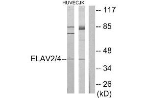 Western Blotting (WB) image for anti-ELAV2/4 (ELAV2/4) (Internal Region) antibody (ABIN1849272) (ELAV2/4 Antikörper  (Internal Region))