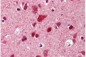Brain, cortex, Human: Formalin-Fixed, Paraffin-Embedded (FFPE) (Ubiquitin Antikörper)