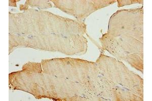 Immunohistochemistry of paraffin-embedded human skeletal muscle tissue using ABIN7159778 at dilution of 1:100 (MAP1LC3A Antikörper  (AA 1-120))