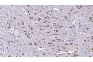Detection of RELN in Human Cerebrum Tissue using Monoclonal Antibody to Reelin (RELN) (Reelin Antikörper  (AA 2978-3373))