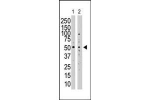 Western blot analysis of SUV39H1 polyclonal antibody  in SAOS-2 cell lysate (Lane 1) and NIH/3T3 cell lysate (Lane 2) . (SUV39H1 Antikörper  (N-Term))