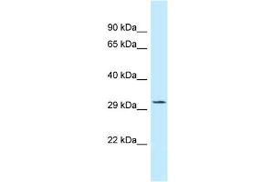 Western Blotting (WB) image for anti-TIP41-like protein (TIPRL) (C-Term) antibody (ABIN2500312) (TIPRL Antikörper  (C-Term))